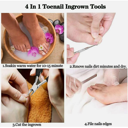 Ingrown Toenail Hawkbill Pliers, Heavy-Duty Toenail Clippers, Suitable for Thick and Ingrown Nails, Precision Nail Clippers.