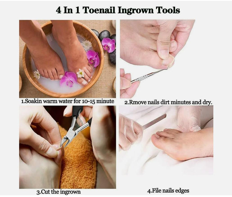 Ingrown Toenail Hawkbill Pliers, Heavy-Duty Toenail Clippers, Suitable for Thick and Ingrown Nails, Precision Nail Clippers.