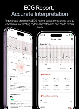 Nuovo Smartwatch 2026 con Analisi del Grasso Corporeo ECG+PPG, Acido Urico, Pressione Sanguigna, Ossigeno nel Sangue, Chiamate Bluetooth, Orologio Sportivo Intelligente per Uomini e Donne platinumshop