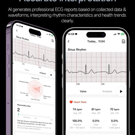 Nuovo Smartwatch 2026 con Analisi del Grasso Corporeo ECG+PPG, Acido Urico, Pressione Sanguigna, Ossigeno nel Sangue, Chiamate Bluetooth, Orologio Sportivo Intelligente per Uomini e Donne platinumshop