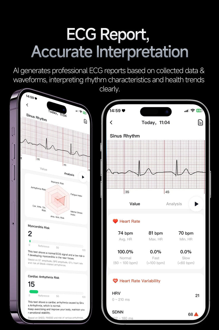 Nuovo Smartwatch 2026 con Analisi AI del Grasso Corporeo, ECG+PPG, Acido Urico, Pressione Sanguigna, Ossigeno nel Sangue, Chiamate, Schermo AMOLED per Uomini e Donne platinumshop