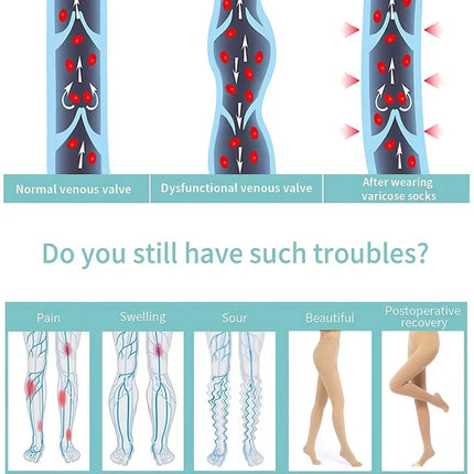 Collant a compressione medica 15-20 MmHg Calze di supporto graduate per infermieri Stecche per tibia Volo Viaggi Vene varicose
