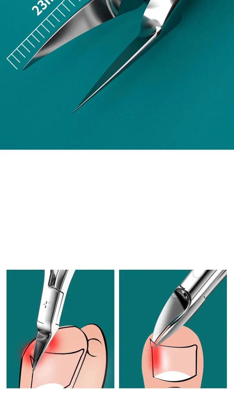 Sharp Toenail Ingrown Cuticle Nipper Nail Clipper Edge Cutter Scissor Nail Pliers Tool Dead Skin Remover Pedicure Manicure Tools