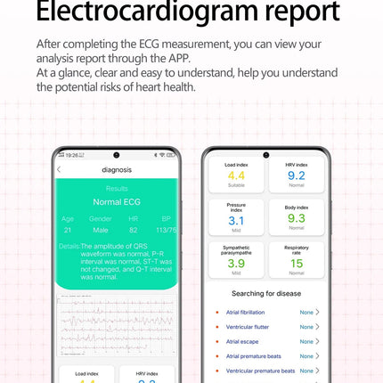 2026 Nuovo aggiornamento AI diagnostico Airbag pressione sanguigna precisa salute SmartWatch acido urico ECG lipidi nel sangue Smartwatch uomo donna platinumshop
