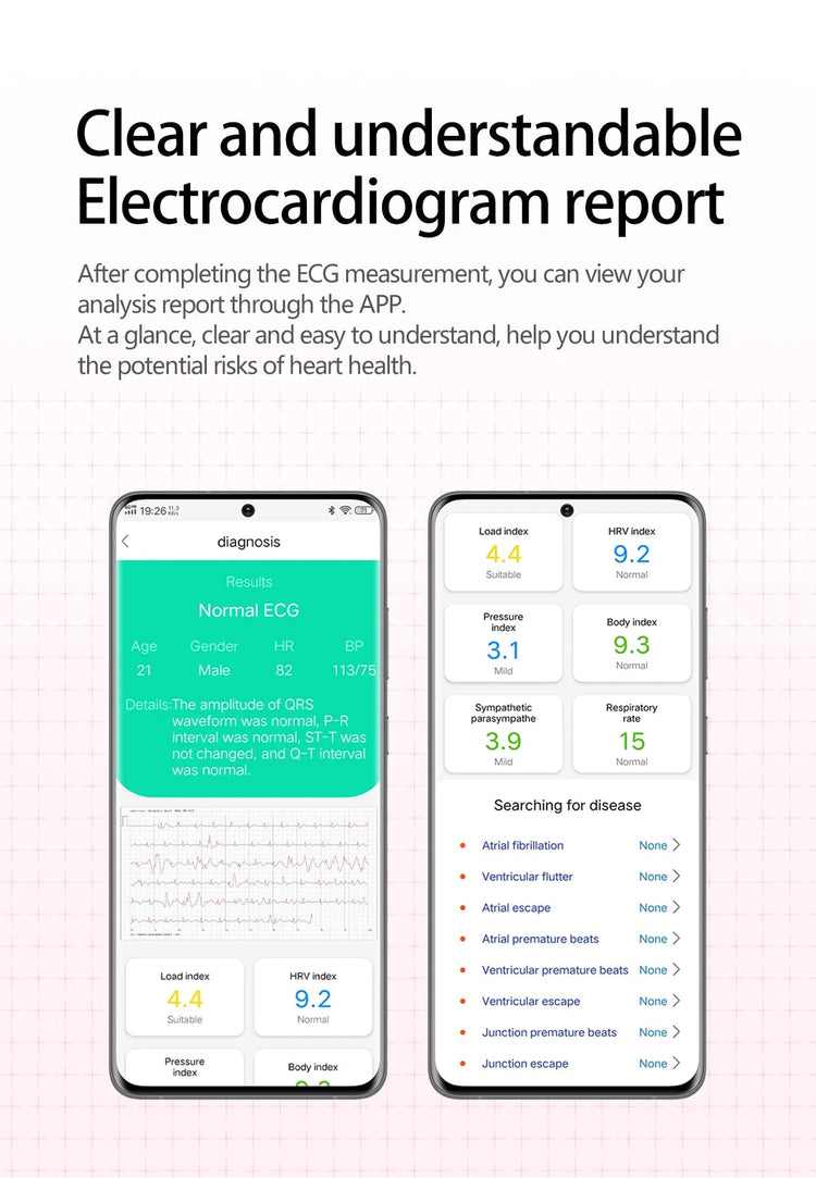 2026 Nuovo aggiornamento AI diagnostico Airbag pressione sanguigna precisa salute SmartWatch acido urico ECG lipidi nel sangue Smartwatch uomo donna platinumshop