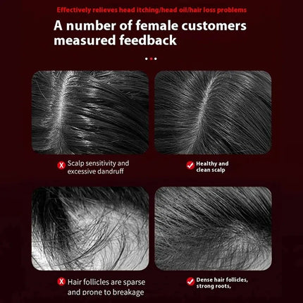 Factory Direct 2026 Electric Hair Regrowth Brush with Infrared Light Machine Acupoint Scalp Massage Anti-Hair Loss Exercise Hair