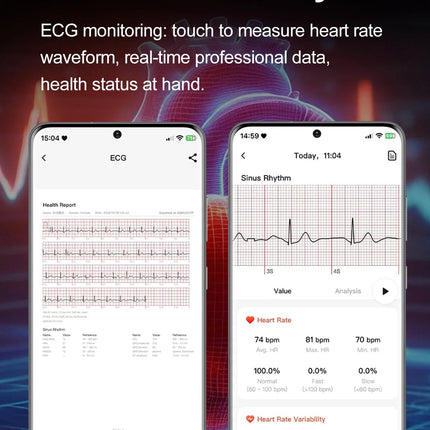 Nuovo Smartwatch 2026 per Analisi del Grasso Corporeo, ECG+PPG, Acido Urico, Pressione Sanguigna, Ossigeno nel Sangue, Orologio con Chiamate per Uomini e Donne platinumshop