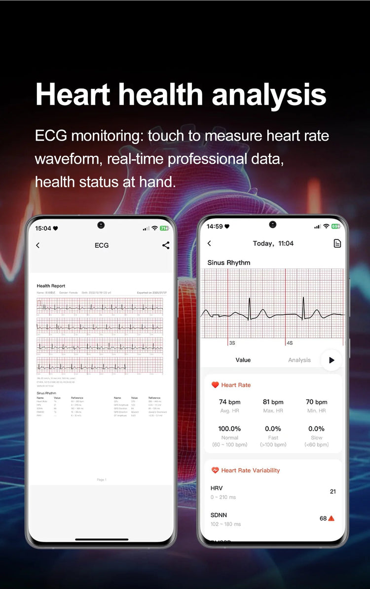 Nuovo Smartwatch 2026 per Analisi del Grasso Corporeo, ECG+PPG, Acido Urico, Pressione Sanguigna, Ossigeno nel Sangue, Orologio con Chiamate per Uomini e Donne platinumshop