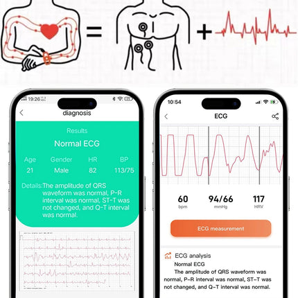 2026 Nuovo 650nm Terapia Laser Grassi nel sangue Acido urico Pressione sanguigna Smart Watch ECG + PPG Preciso Monitor di salute Smartwatch per gli uomini platinumshop