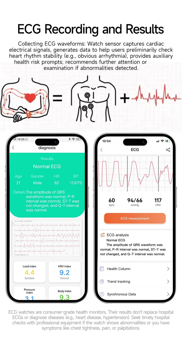 2026 Nuovo 650nm Terapia Laser Grassi nel sangue Acido urico Pressione sanguigna Smart Watch ECG + PPG Preciso Monitor di salute Smartwatch per gli uomini platinumshop
