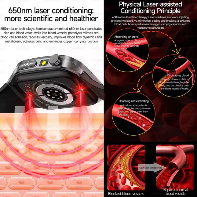 2026 Nuovo 650nm Terapia Laser Grassi nel sangue Acido urico Pressione sanguigna Smart Watch ECG + PPG Preciso Monitor di salute Smartwatch per gli uomini platinumshop