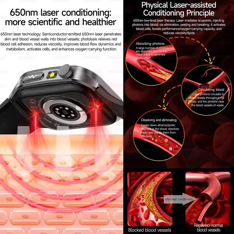 2026 Nuovo 650nm Terapia Laser Grassi nel sangue Acido urico Pressione sanguigna Smart Watch ECG + PPG Preciso Monitor di salute Smartwatch per gli uomini platinumshop