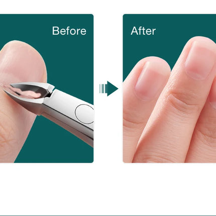 MR.GREEN Nail Cuticle Nipper Manicure Scissors Stainless Steel Dead Skin Remover Pusher Tool Trimmer