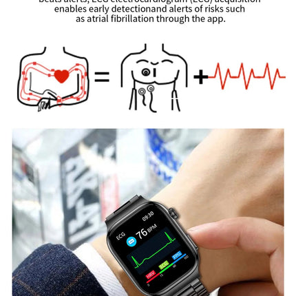 2026 Nuovo Misurazione Accurata Salute Smart Watch ECG + PPG Acido Urico Pressione Sanguigna Lipidi Nel Sangue Chiamata BT Smartwatch Per Le Donne Degli Uomini platinumshop