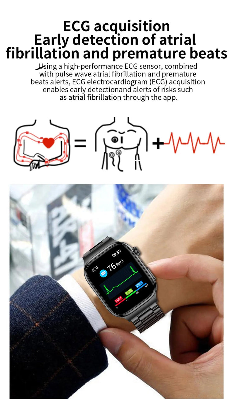 2026 Nuovo Misurazione Accurata Salute Smart Watch ECG + PPG Acido Urico Pressione Sanguigna Lipidi Nel Sangue Chiamata BT Smartwatch Per Le Donne Degli Uomini platinumshop